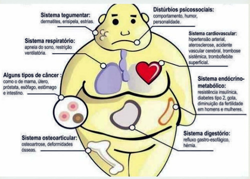 Transtornos Alimentares 