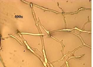 Miclio com hifas no septadas ou cenocticas