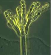 Conidiforo de Penicillium sp